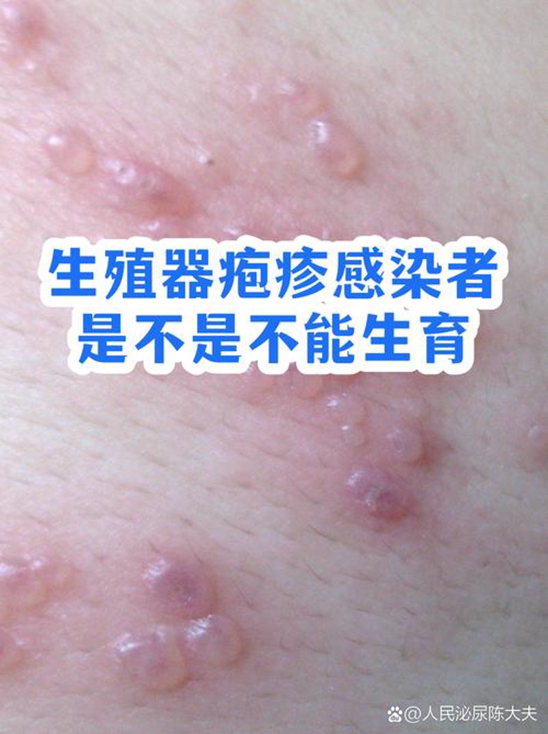 聚焦许昌男科医院：专业诊疗引领健康新风尚